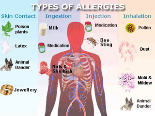 http://www.myproactivewellness.com/allergies.html